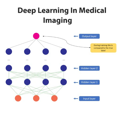 Deep learning