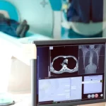 Main Manuscript Categories in Cardiovascular Computed Tomography