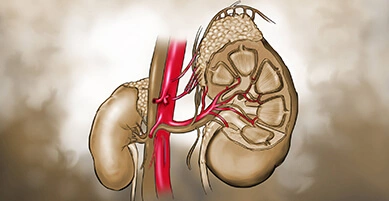 Kidneys_02