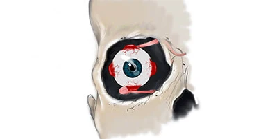 eye_03